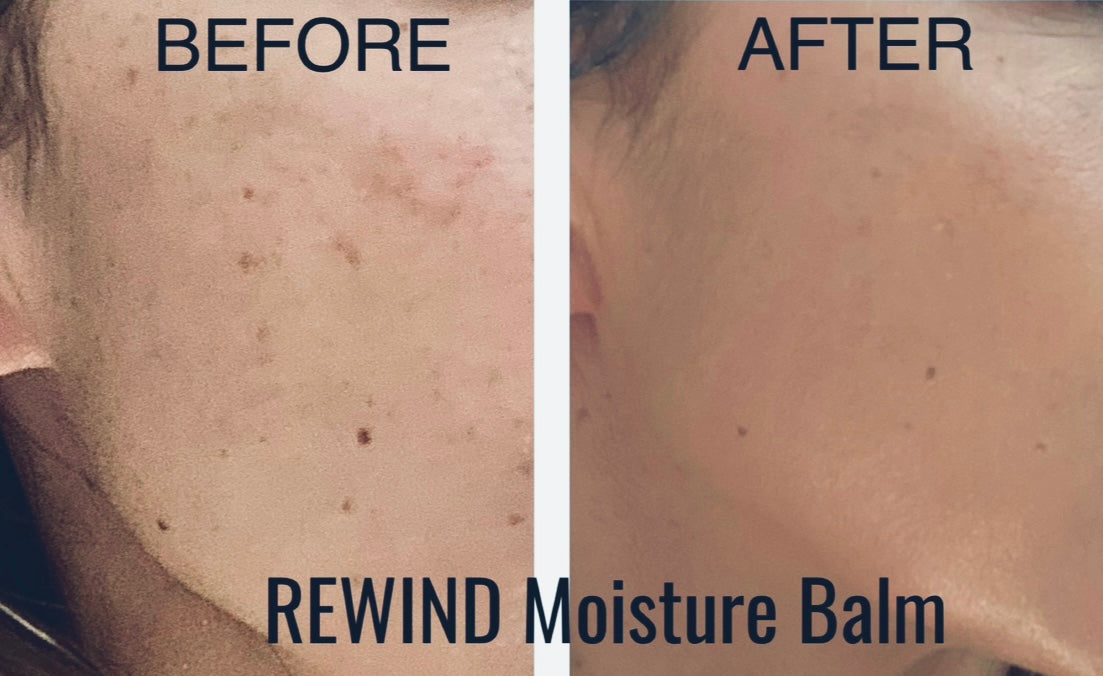 REWIND Moisture Stick with Vitamin C